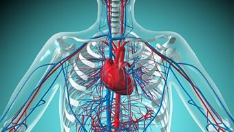 Na doença coronariana obstrutiva, o entupimento dos vasos leva a interrupção do fluxo sanguíneo