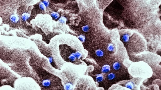 Imagem de microscópio colorida artificialmente mostrando o vírus HIV atacando células de defesa em laboratório. 2016.