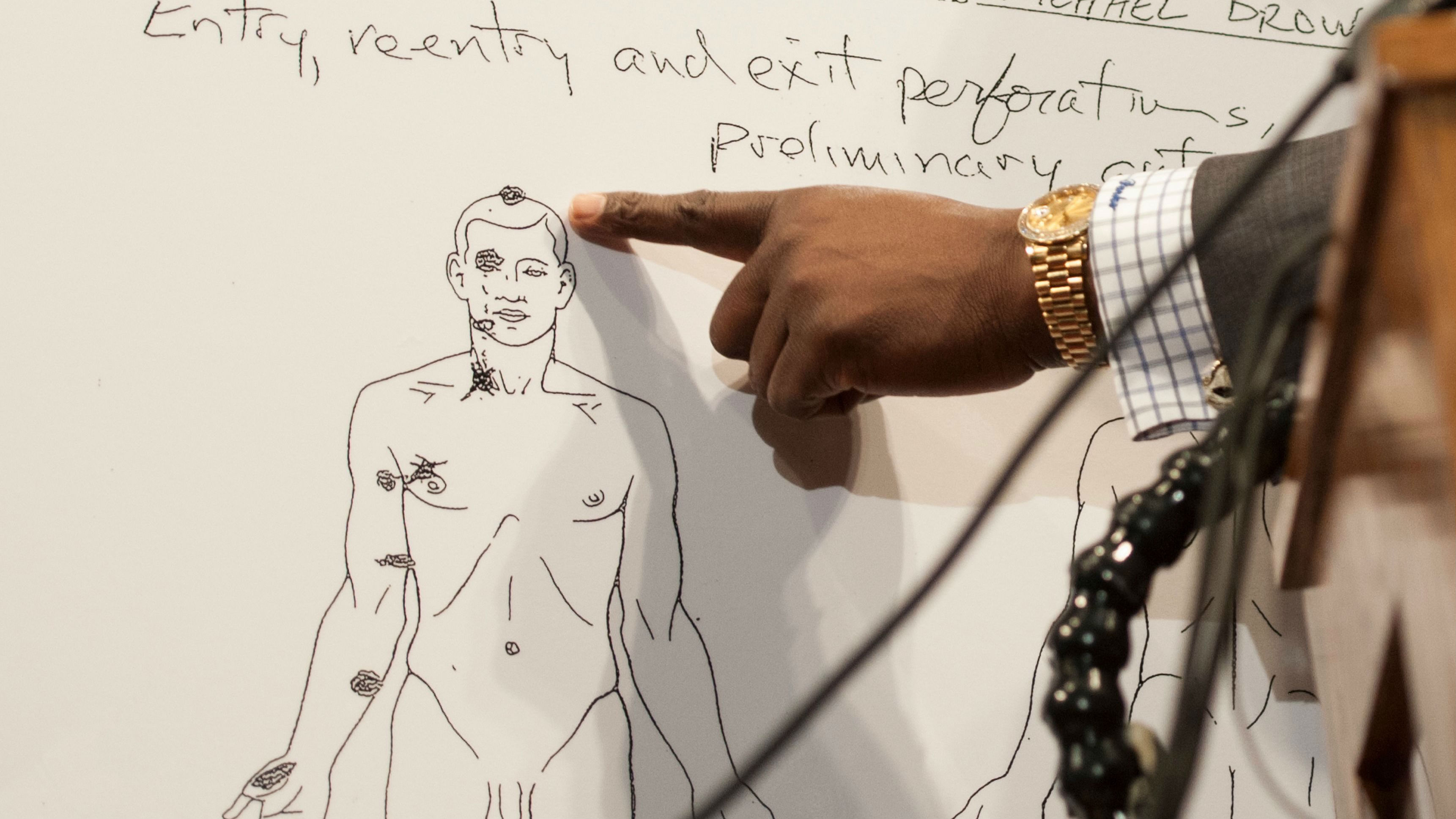 Desenho sintetiza os resultados da autópsia independente realizada em Michael Brown