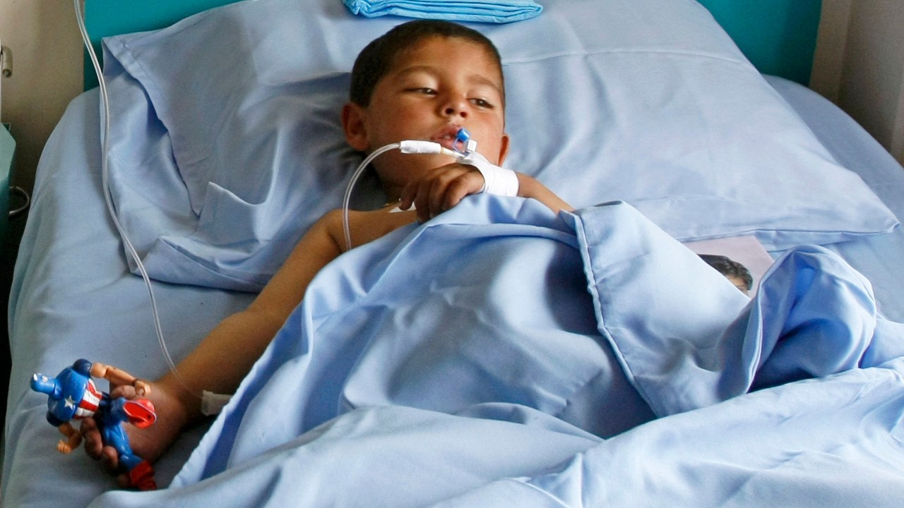 Menino recebe tratamento em hospital de Cabul depois de ficar ferido em ataque suicida durante jogo de vôlei no distrito de Paktika