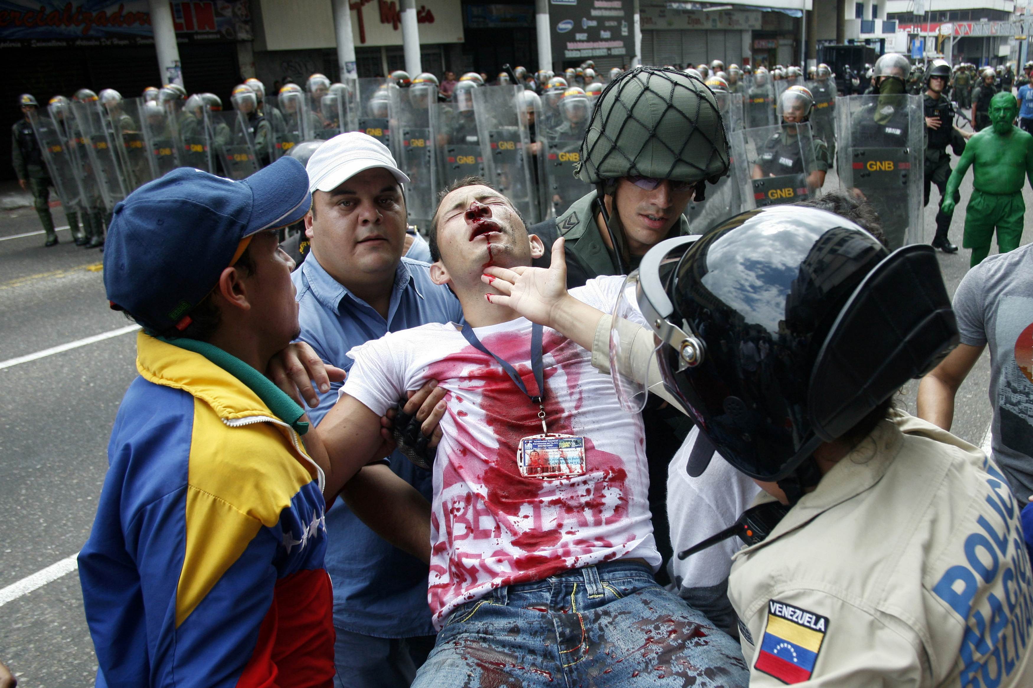 Estudantes voltam às ruas um ano depois da onda de protestos na Venezuela |  VEJA