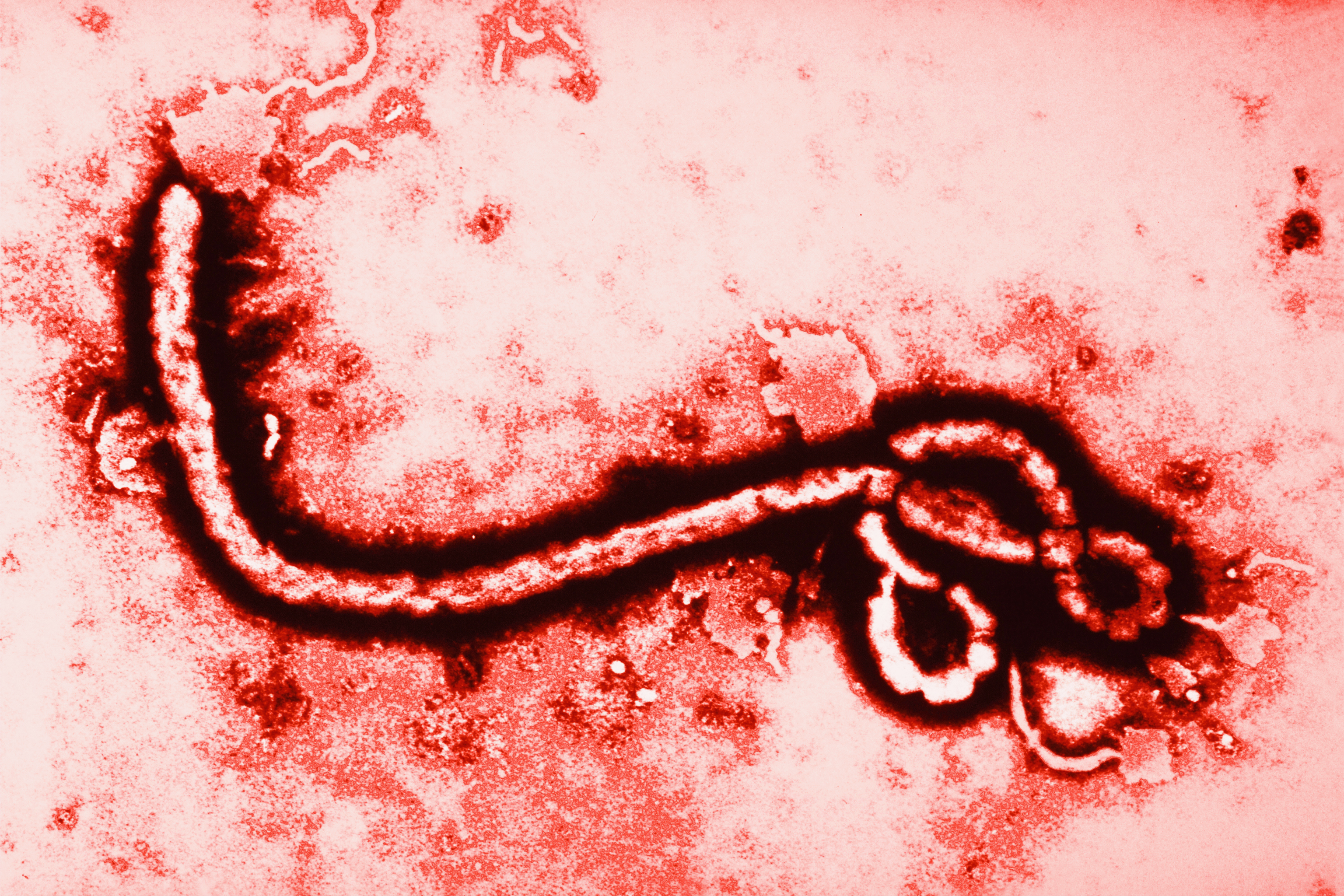 Vírus do ebola