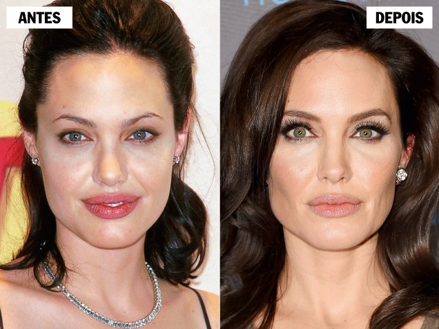 ANGELINA JOLIE - Antes das operações preventivas contra o câncer de mama e de ovário, a atriz recorreu ao bisturi para ressaltar as maçãs do rosto ANGELINA JOLIE - Antes das operações preventivas contra o câncer de mama e de ovário, a atriz recorreu ao bisturi para ressaltar as maçãs do rosto