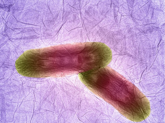 <p>Duas bactérias em forma de bastonete se posicionam em cima de uma folha de carbono de um átomo de espessura. A imagem foi obtida por Izzat Suffian, Kuo-Ching Mei, Houmam Kafa e Khuloud T Al-Jamal, do King’s College de Londres</p>