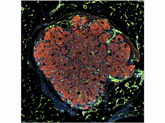<p>A imagem, tirada por Chelsea Fortin, Kelly Stevens e Sangeeta Bhatia, do Koch Institute, nos Estados Unidos, mostram um pequeno pedaço de tecido hepático humano inserido em um rato com problemas no fígado</p>