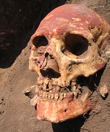 Crânio humano asiático da Idade do Bronze (entre 3.300 a.C. e 700 a.C.) da cultura Yamnaya, que apresentava a bactéria 'Y. pestis', causadora da peste negra