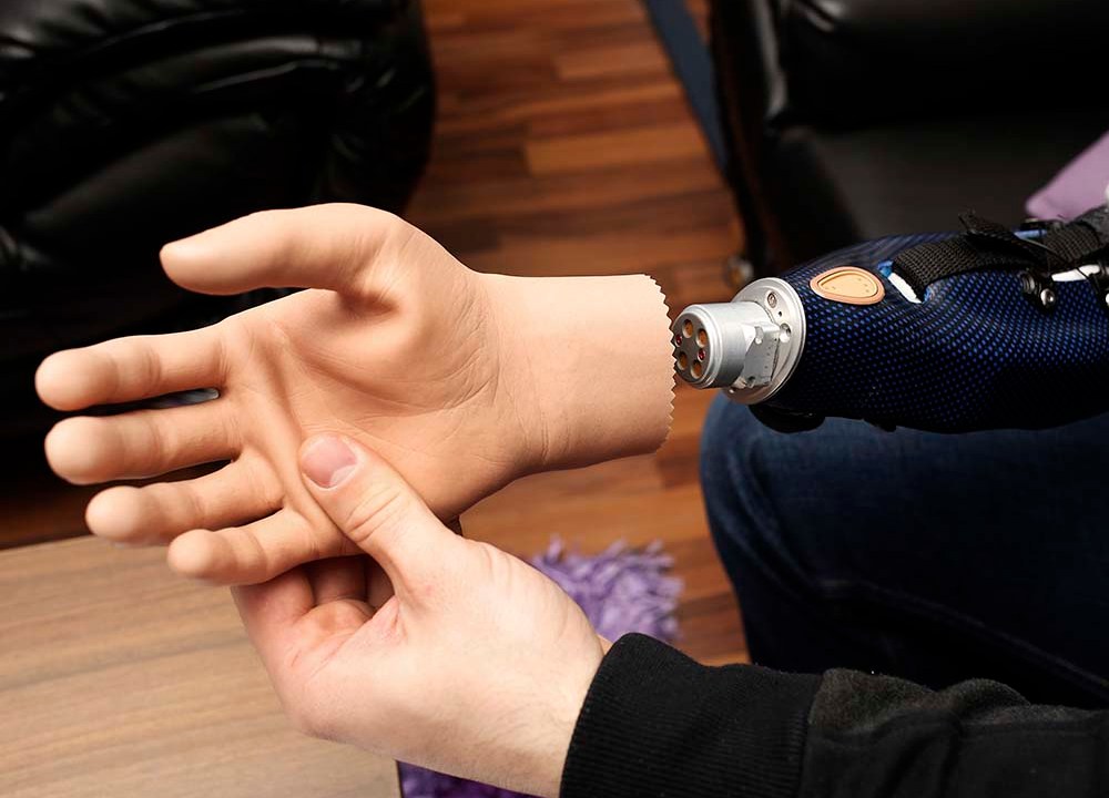 Mão biônica controlada pela mente é desenvolvida na Universidade de Viena, na Áustria