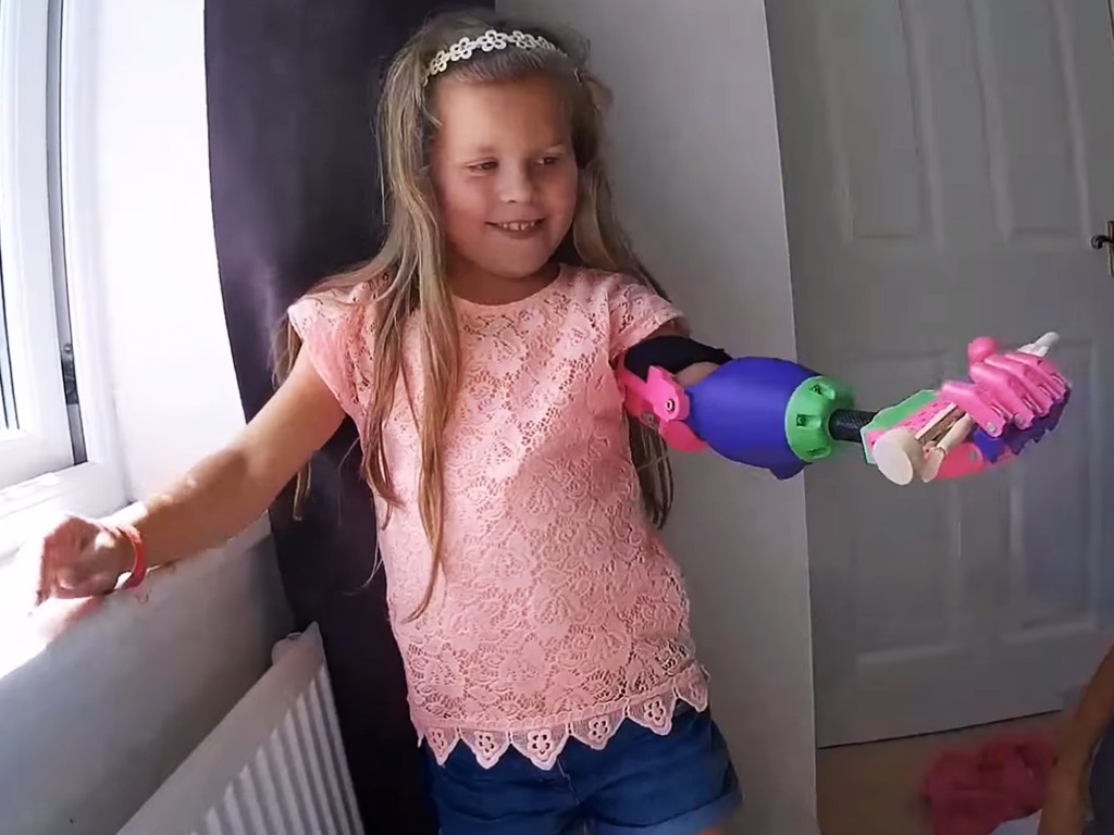 Isabella recebe um braço mecânico feito em uma impressora 3D