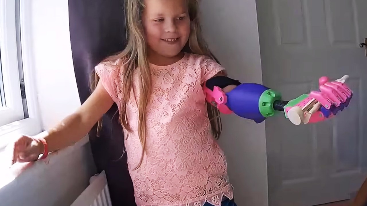 Isabella recebe um braço mecânico feito em uma impressora 3D