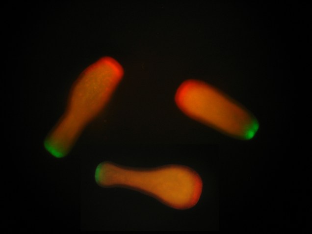 <p>Imagem, com uso de luz fluorescente, de larvas de Acropora millepora</p>