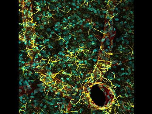 Quinto lugar: Córtex cerebral de rato, com núcleos celulares em verde, astrócitos (células que ajudam na sustentação e nutrição dos neurônios) em amarelo e vasos sanguíneos em vermelho