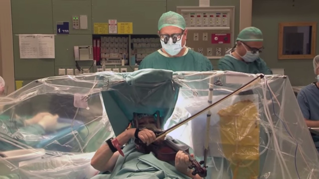 A paciente melhorou a habilidade de tocar o violino no decorrer da cirurgia