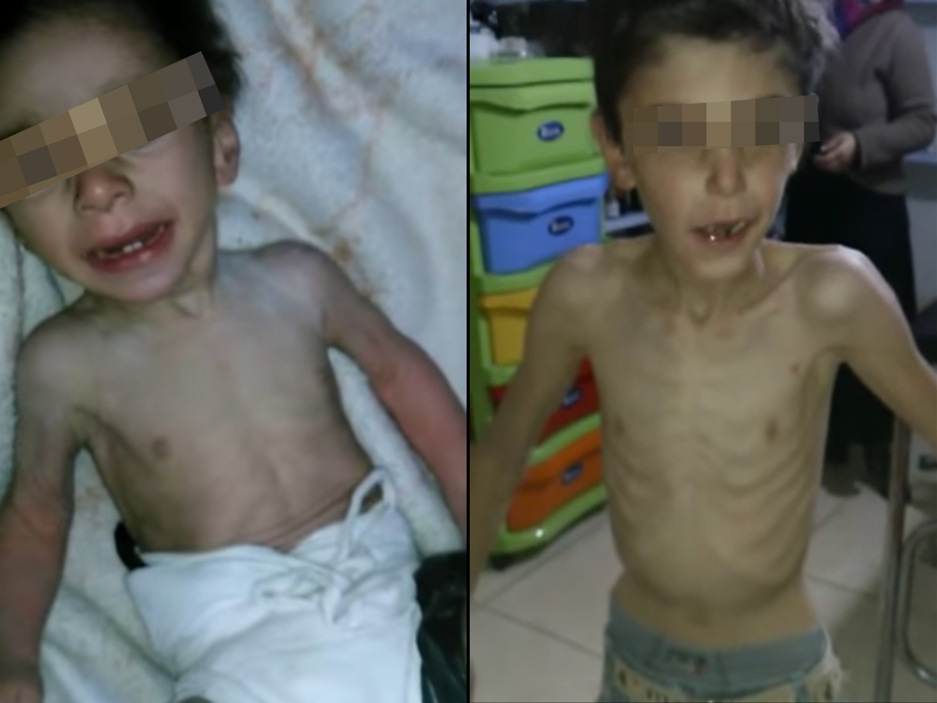 Crianças sofrem com a falta de alimentos na cidade sitiada de Madaya, Síria