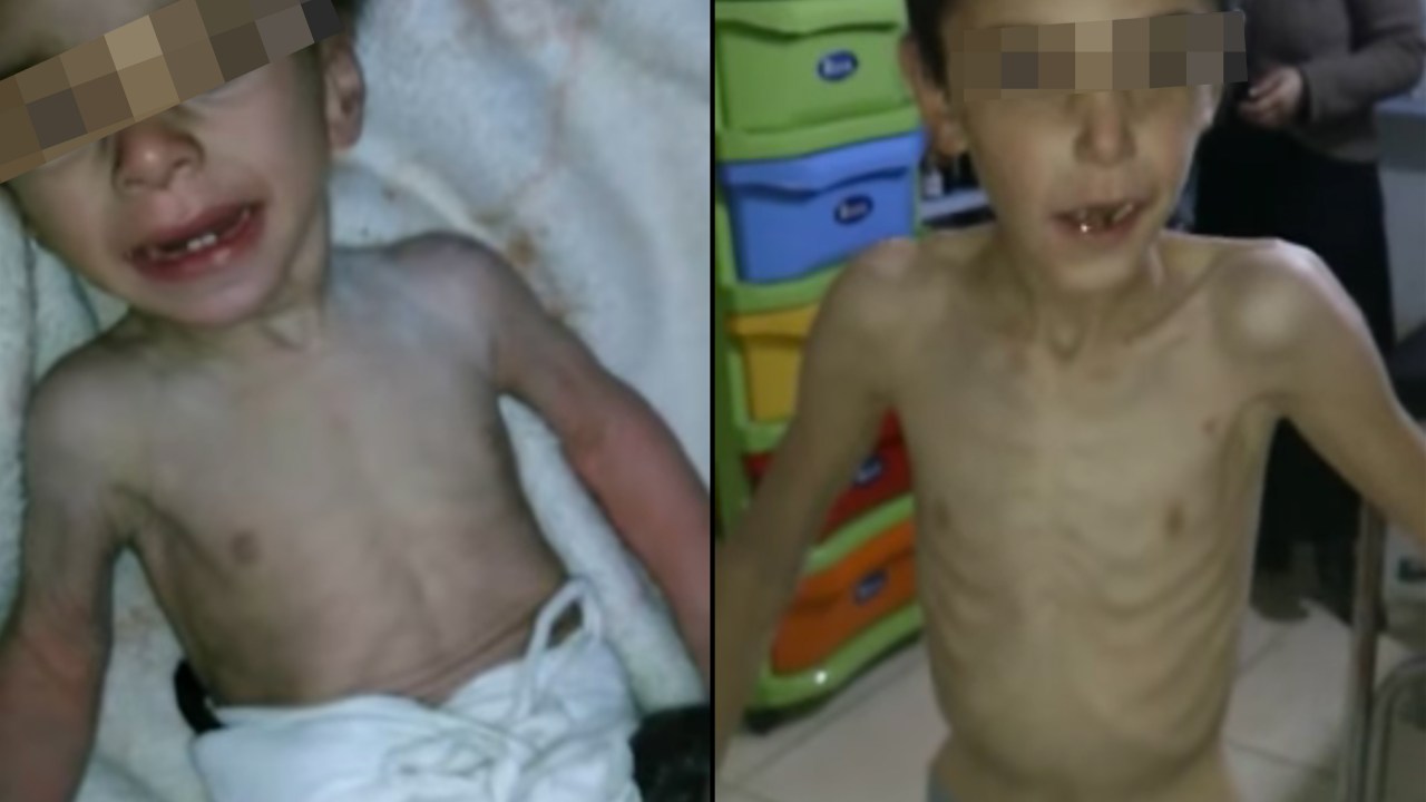 Crianças sofrem com a falta de alimentos na cidade sitiada de Madaya, Síria