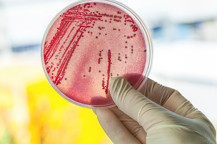 Estudio argentino analiza cómo evoluciona la resistencia microbiana en paciente con fibrosis quística