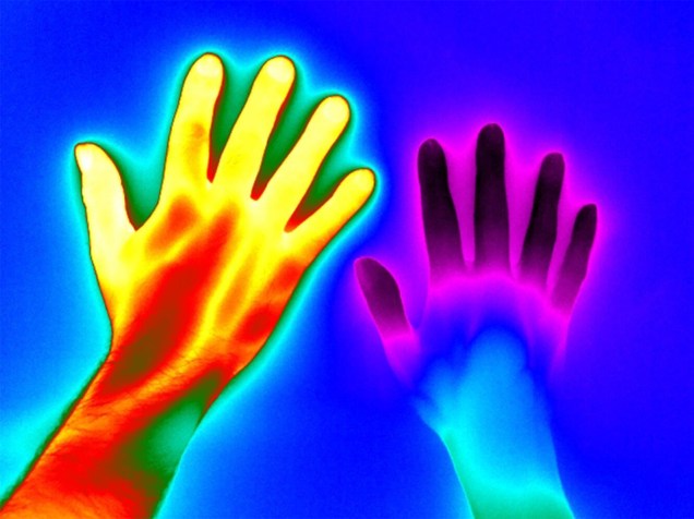 <p>A imagem infravermelha, tirada por Matthew Clavey, da Thermal Vision Research, no Reino Unido, compara uma mão saudável (à esquerda), com uma que apresenta a doença de Raynaud (à direita).  A doença afeta mãos e pés, causando redução no fluxo de sangue</p>