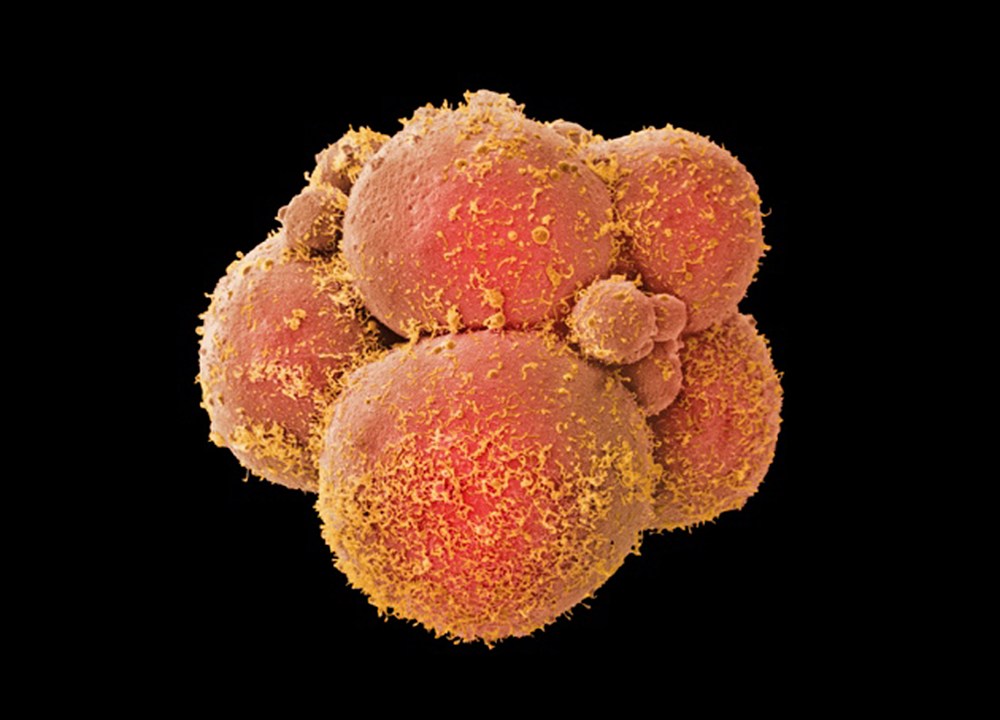 Embrião humano
