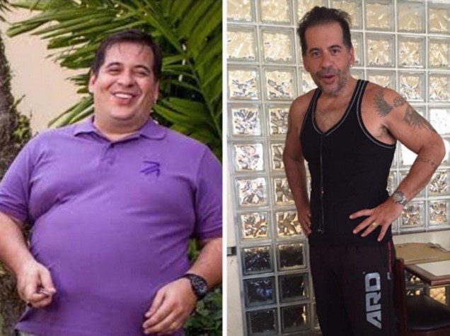 Leandro Hassum perdeu 65 quilos após a cirurgia bariátrica