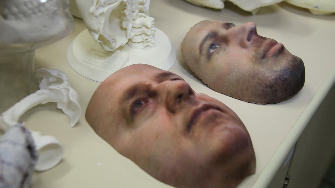 No Centro de Tecnologia da Informação Renato Archer, em Campinas, réplicas do rosto de pacientes feitas com impressoras 3D ajudam a planejar cirurgias de reconstituição da face