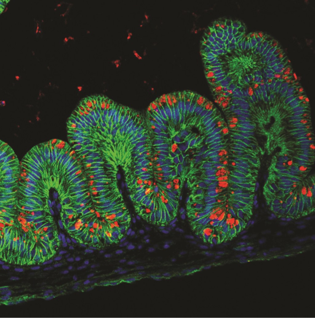 Em verde na imagem, tecidos de estômago humano que foram criados pelos cientistas e que contêm células que, assim como o órgão, conseguem produzir muco (em vermelho)