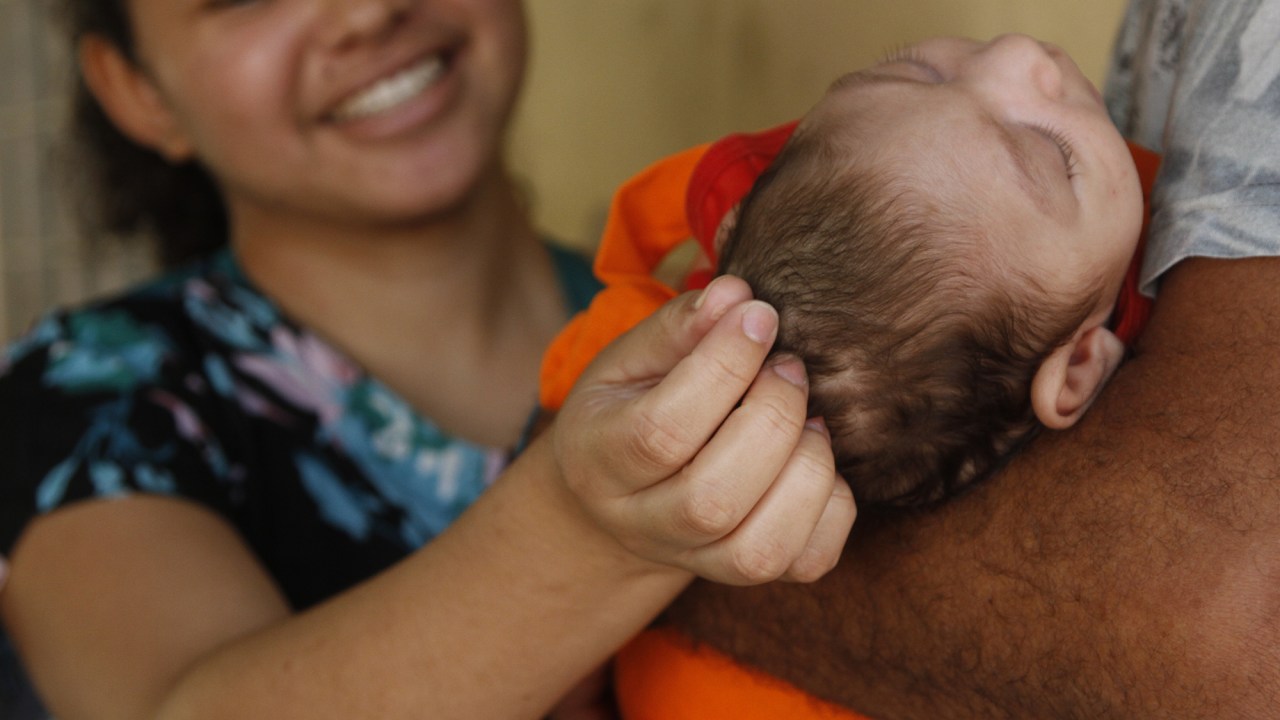 O bebê nasceu há um mês em Guarulhos com um perímetro cefálico de 28 centímetros. A mãe apresentou sintomas da infecção por zika no início da gestação e não tem histórico de viagem para Estados atingidos pela doença