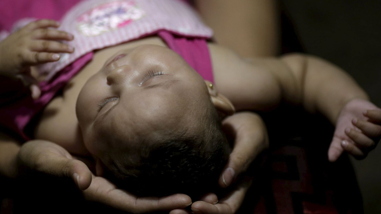 Mãe segura filho que nasceu com microcefalia, no hospital IMIP em Recife
