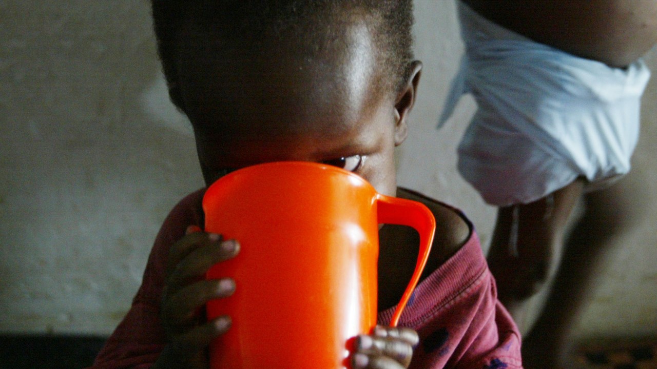 Criança desnutrida em Monróvia, na Libéria