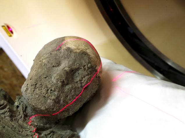 <p>Molde de gesso de garoto da antiga cidade de Pompeia, destruída pela erupção do Vesúvio, é submetido a tomografia computadorizada </p>