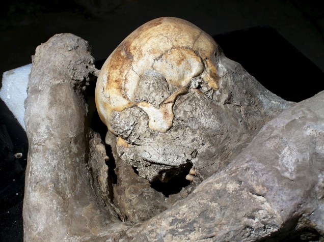 <p>Uma pesquisa sem precedentes submeteu a tomografias computadorizadas (TAC) 30 corpos encontrados nas escavações de Pompeia que ficaram conservados nos moldes de gesso em que foram tratados</p>