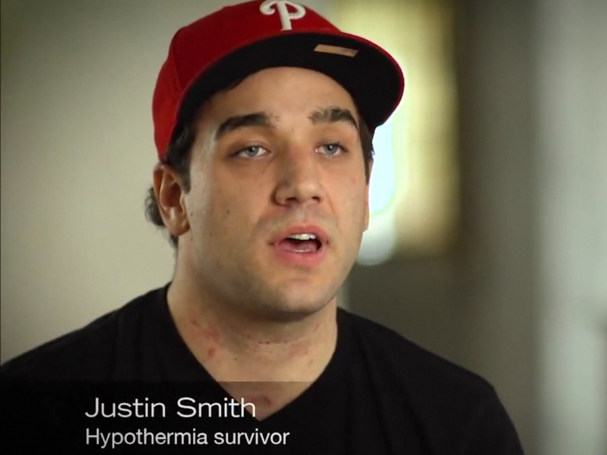 Após passar a noite desacordado na neve, Justin Smith entrou em um estado de hipotermia grave, mas conseguiu ser salvo com uma técnica que aquece o sangue antes de bombeá-lo de volta ao corpo