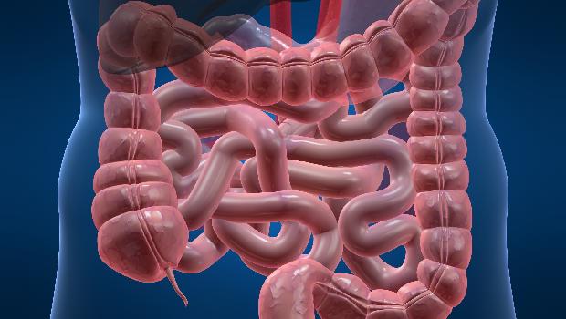 Doença inflamatória intestinal: Laboratório japonês desenvolveu nova droga que pode ajudar a tratar doença de Crohn e colite ulcerativa