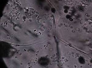 A bactéria Pseudomonas syringae em meio a cristais de gelo catalisados por ela