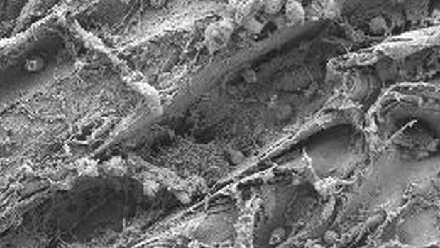 Dieta tóxica: imagem de microscópio eletrônico mostra bactérias marinhas digerindo plástico. Cientistas ainda não sabem se isso é bom ou ruim para a natureza