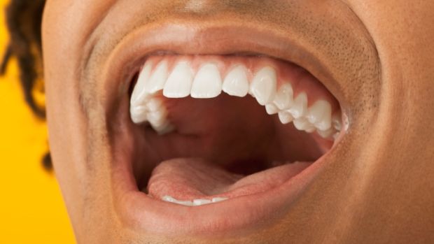 Os componentes ácidos presentes em alguns alimentos e bebidas podem causar o amolecimento do esmalte do dente, o que contribui para a erosão dentária