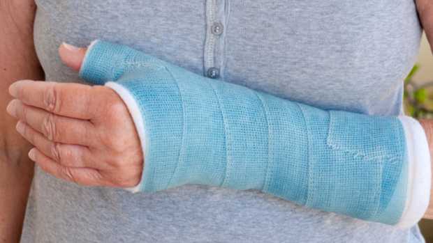 Fratura óssea: ingestão de vitamina D é baixa entre a maioria dos pacientes com trauma no osso