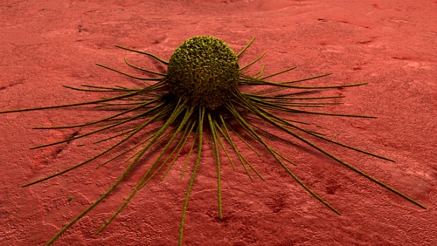Imagem de uma célula cancerígena: na ausência de nutrientes essenciais, elas encontram outras maneiras de se reproduzirem