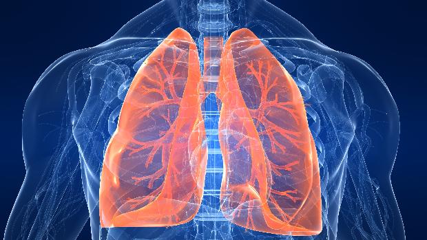 Câncer de pulmão: desequilíbrio de determinados tipos de hormônios pode ser a origem de alguns tumores