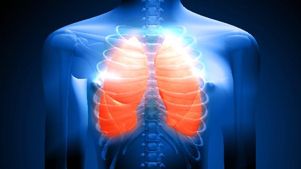 O câncer de pulmão é considerado um dos mais letais, uma vez que sua detecção é feita em estágios tardios da doença