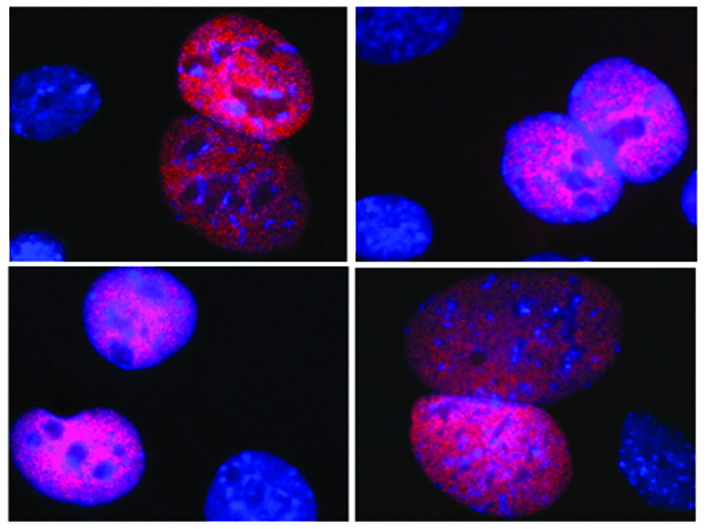 Genes ligados à Amaurose Congênita de Leber em imagem microscópica mostram mutações