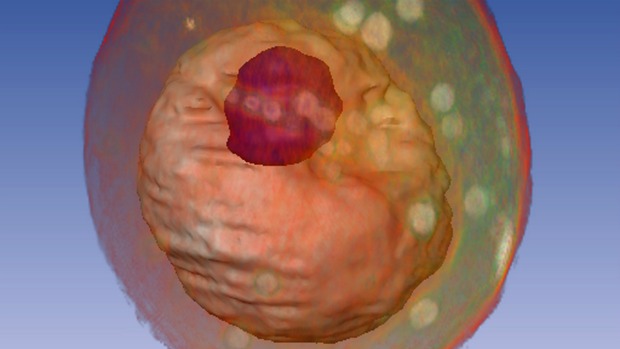 Microscopia de raios-x revela detalhes da levedura (Saccharomyces cerevisiae). No interior, núcleo e um grande vacúolo (em vermelho) são visíveis