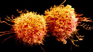 Celulas cancerigenas