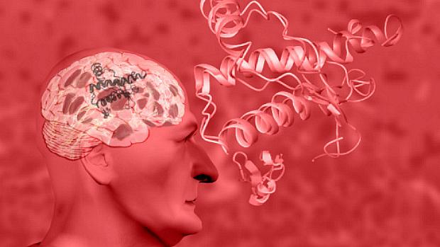 A Alzheimer acontece quando placas da proteína amilóide se depositam no cérebro do indivíduo