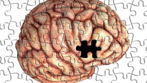 Cerebro Falta Alzheimer