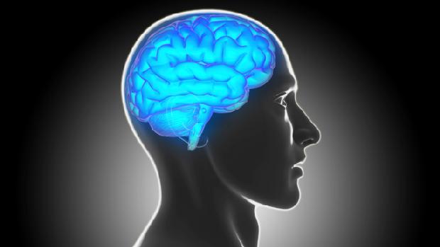 Redução do cérebro de uma paciente com esclerose múltipla