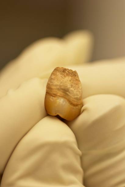Molar de Naia, usado para a extração de DNA