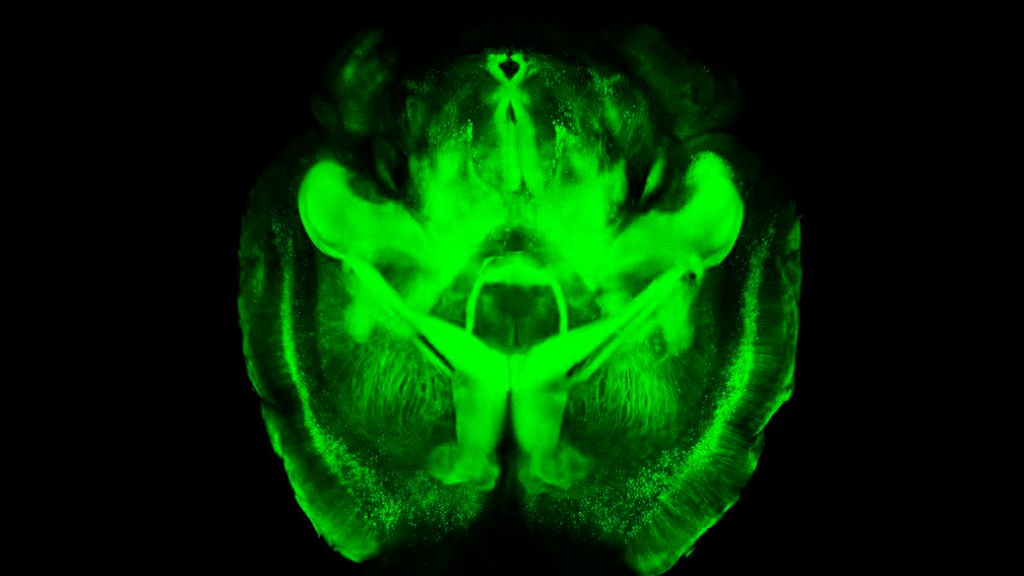 Cérebro transparente