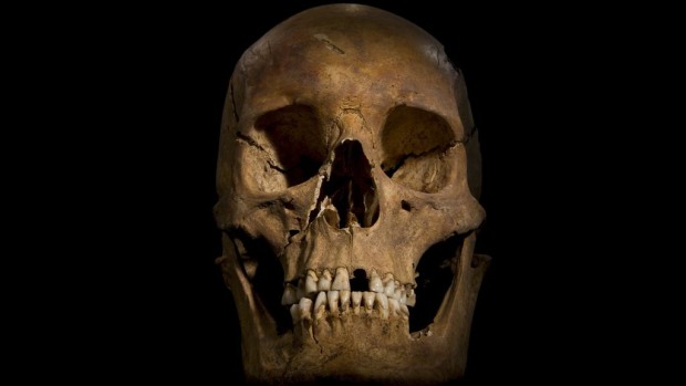 <p>Marcas no crânio de Ricardo III mostram que ele foi morto por golpes na cabeça</p>