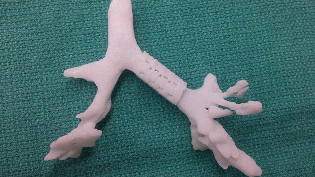 Modelo de traqueia feito para ajudar os médicos a desenvolver o dispositivo que foi implantado em Kaiba Gionfriddo