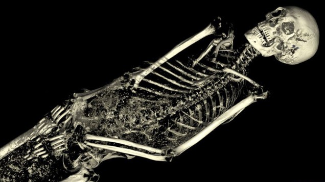 <p>Os cientistas puderam excluir a imagem dos músculos e analisar o esqueleto das múmias</p>