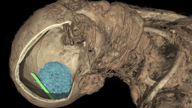 <p>Uma das imagens descobriu uma espátula (em verde) e uma parte do cérebro (em azul) dentro do crânio de um indivíduo</p>